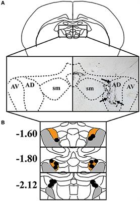 Post-training Inactivation of the Anterior Thalamic Nuclei Impairs Spatial Performance on the Radial Arm Maze